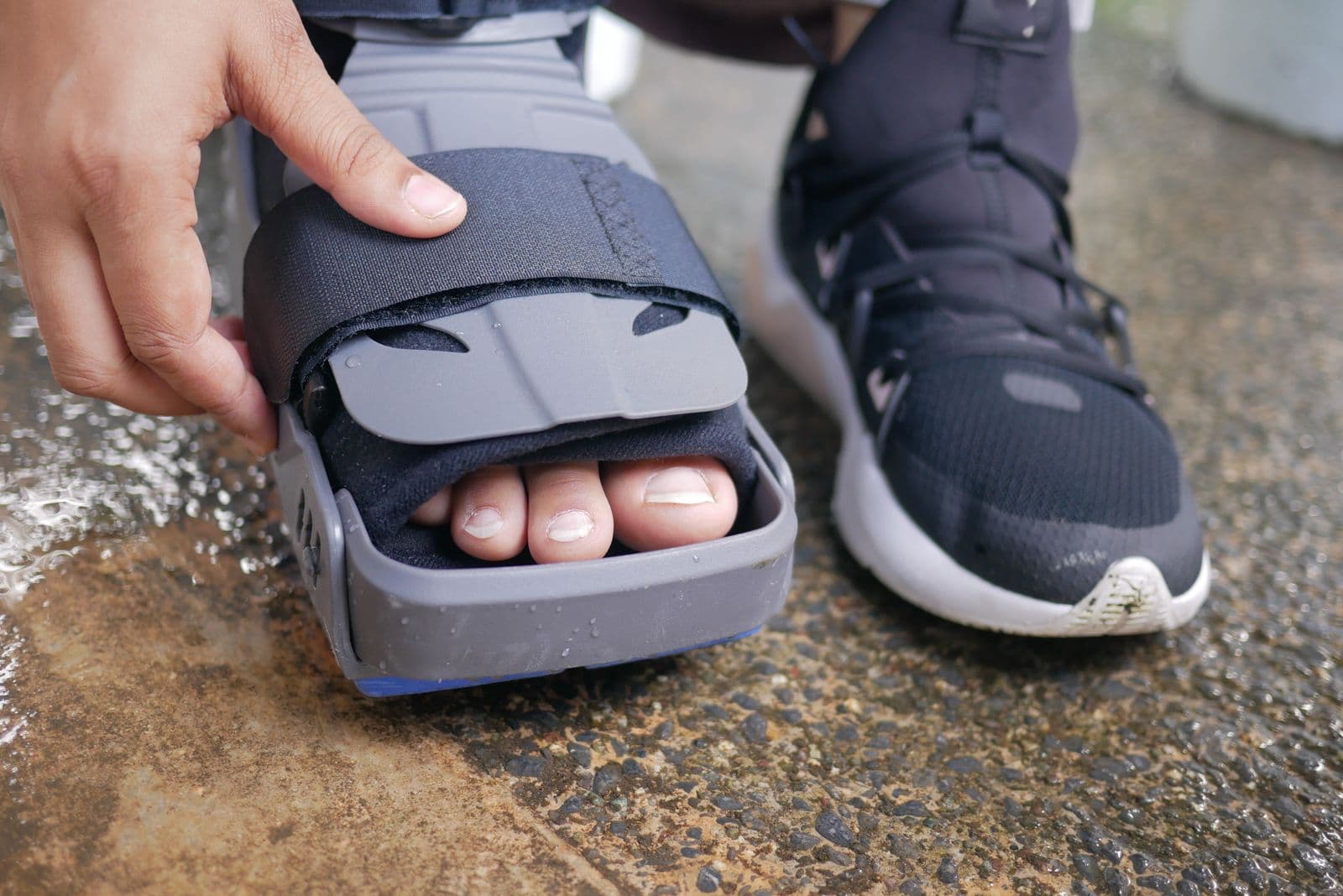 Close-up of a foot in an orthopedic brace during recovery